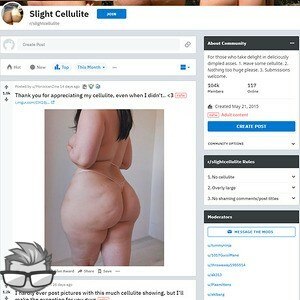 Slight Cellulite - reddit.comrslightcellulite